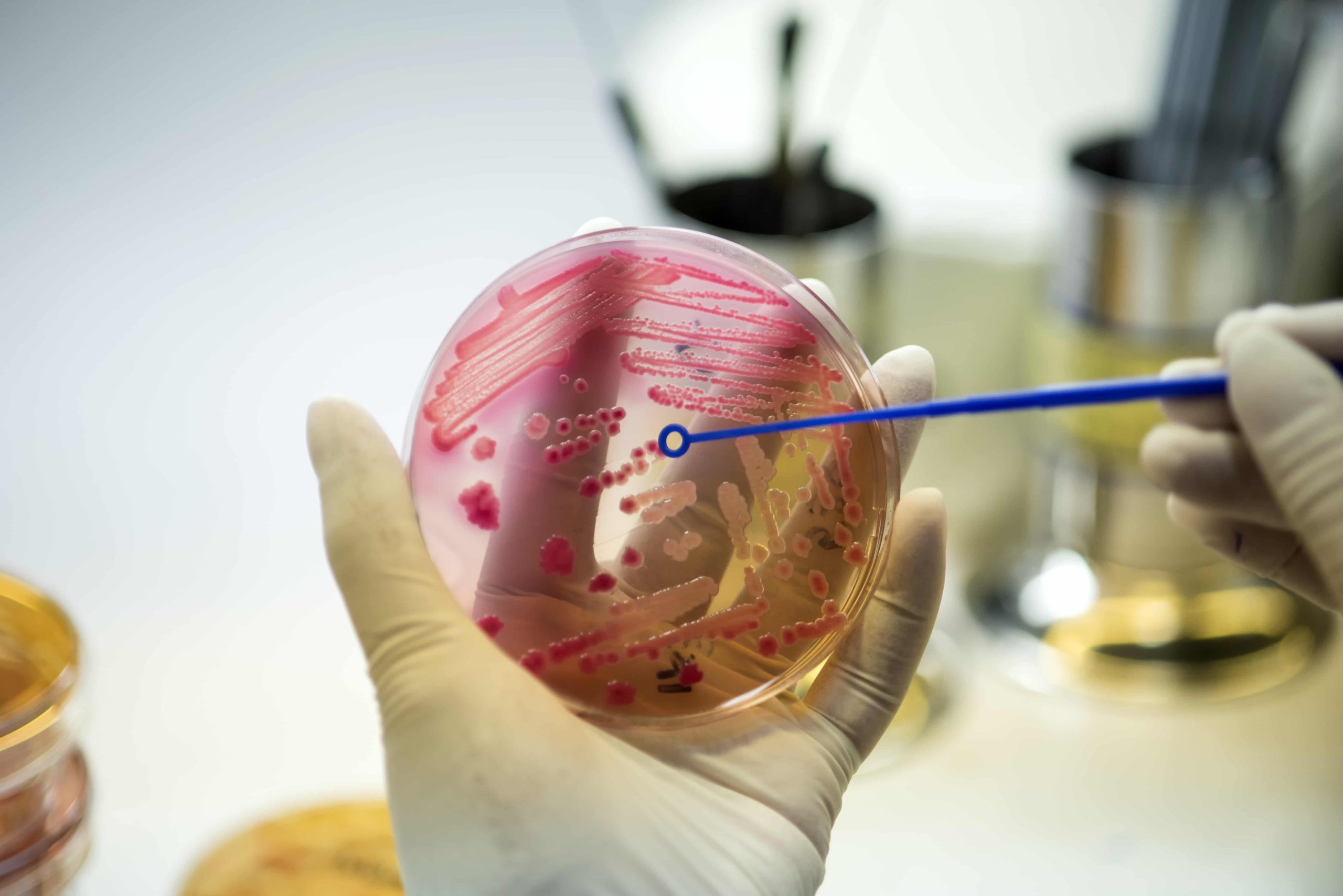 Cellular Therapy for Cancer Treatment