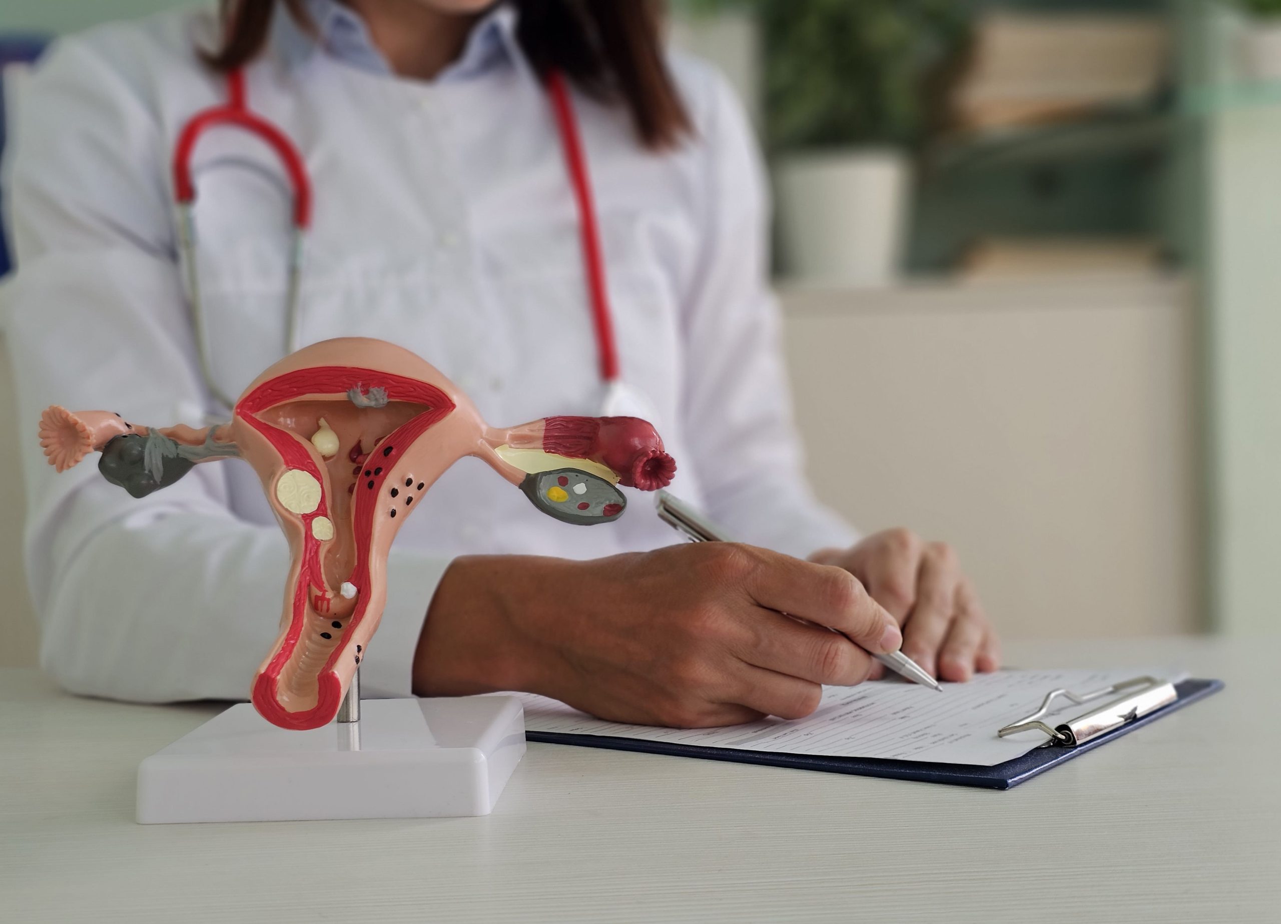 risk factors for ovarian cancer