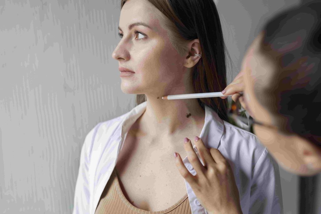 melanoma cancer